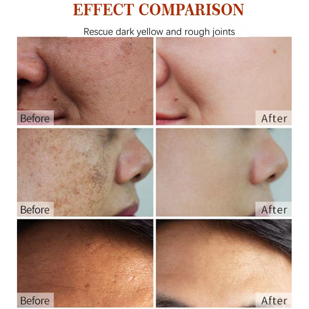 Korean Natural Vegan Vitamin C Dark Spot Remover